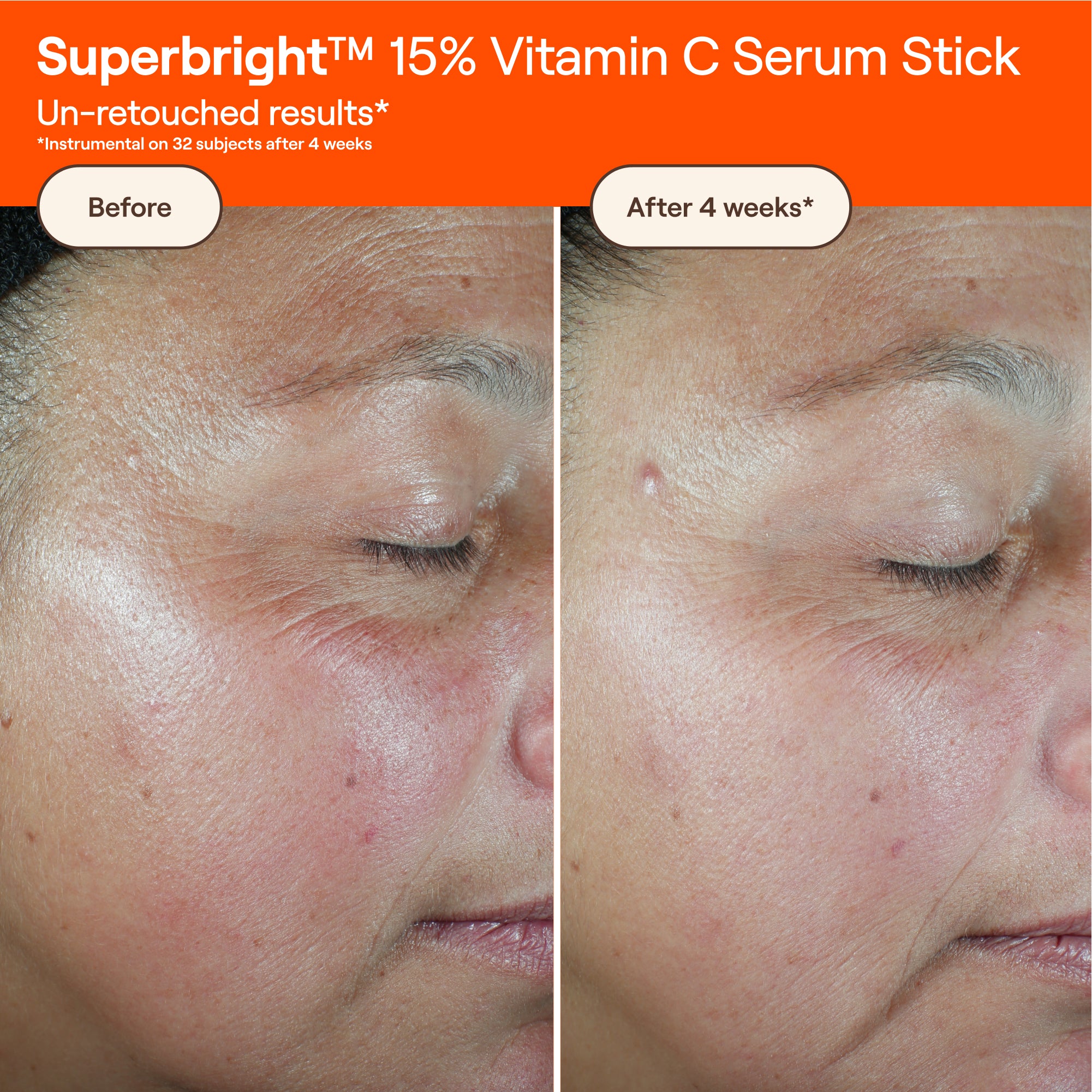 Superbright™ 15% Vitamin C Serum Stick – Live Tinted